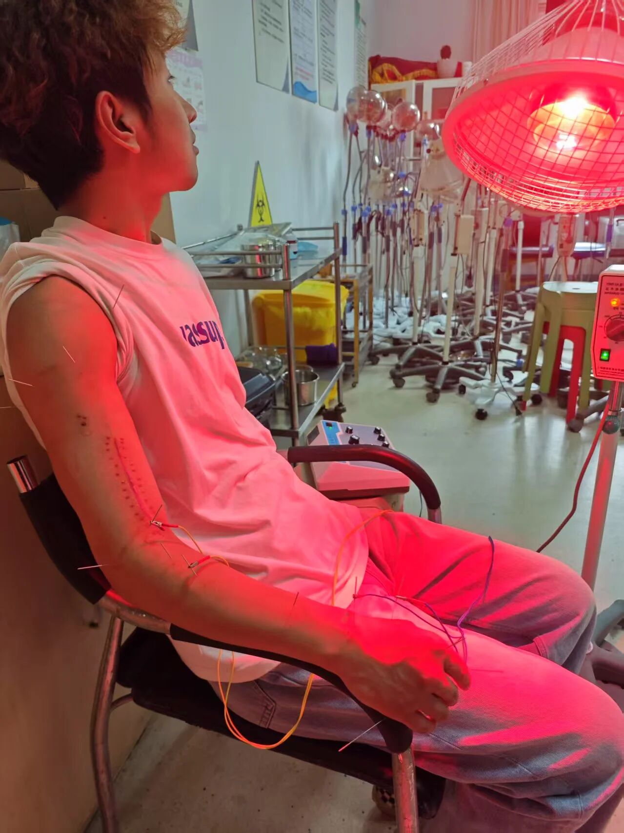 东海康复 | 一次扳手腕骨折后，针灸推拿助他重拾“举手”之力！