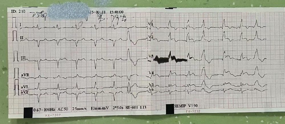 东海医疗 | 8分钟转诊，25分钟救命！医联体联手打通心梗救治“黄金通道”